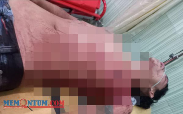 Seorang Pemuda di Klakah Lumajang Jadi Sasaran Aksi Massa dan Pembacokan hingga Sekarat